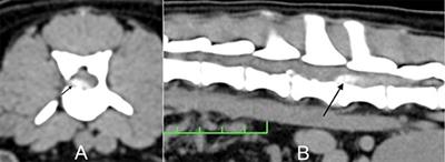 Comparison of the Efficacy of Surgical Decompression Alone and Combined With Canine Adipose Tissue-Derived Stem Cell Transplantation in Dogs With Acute Thoracolumbar Disk Disease and Spinal Cord Injury